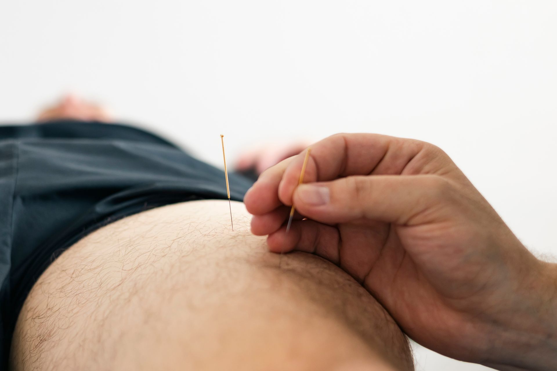 Acupuncturist inserting needles into a patient's leg. Close-up view in a clinical setting.