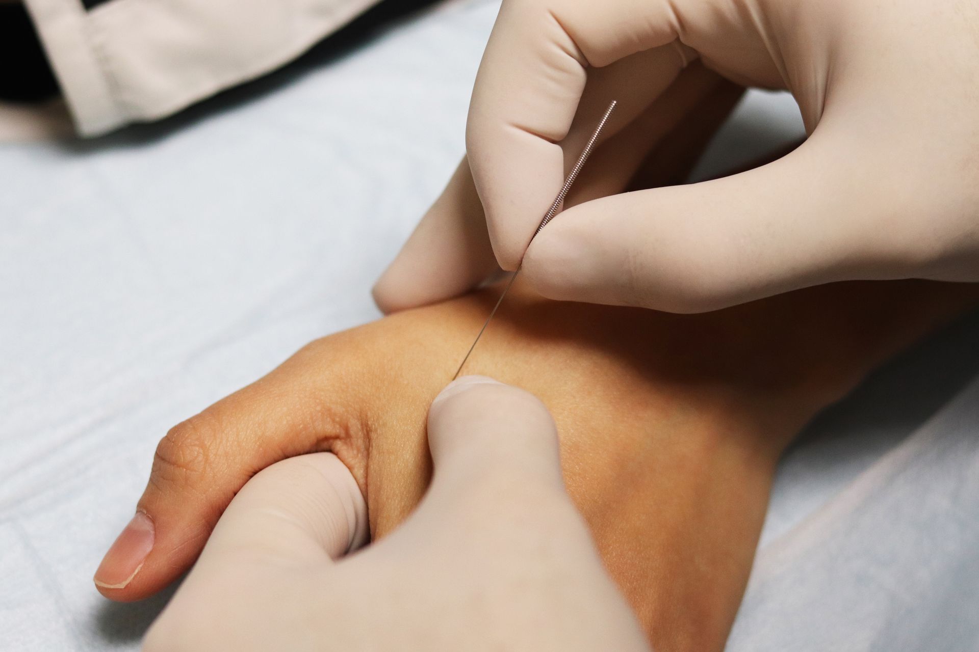 Hands with gloved fingers inserting a needle into the skin of a person’s wrist.