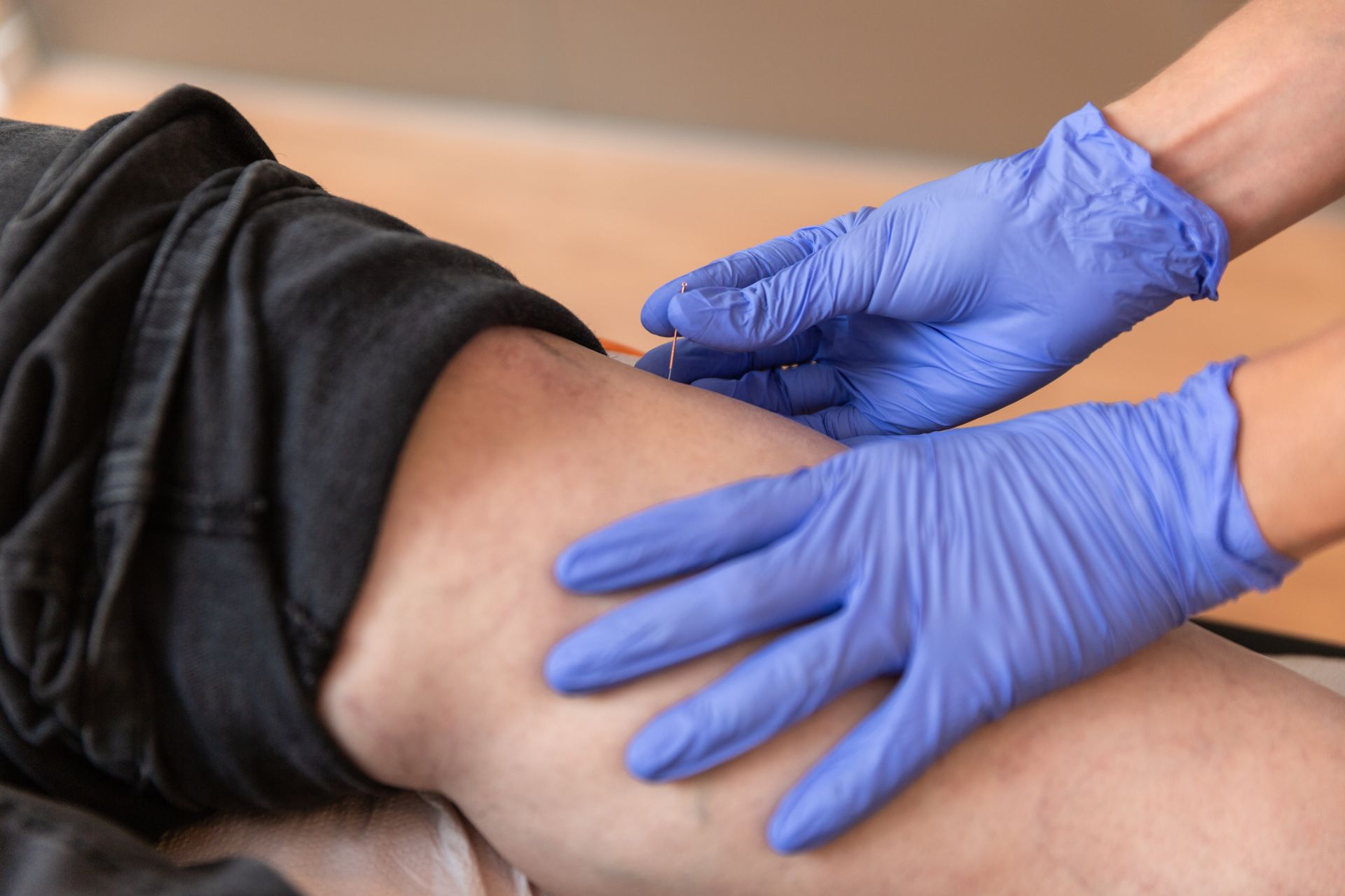 Hands in blue gloves examining a person's thigh; medical setting, detail shot.