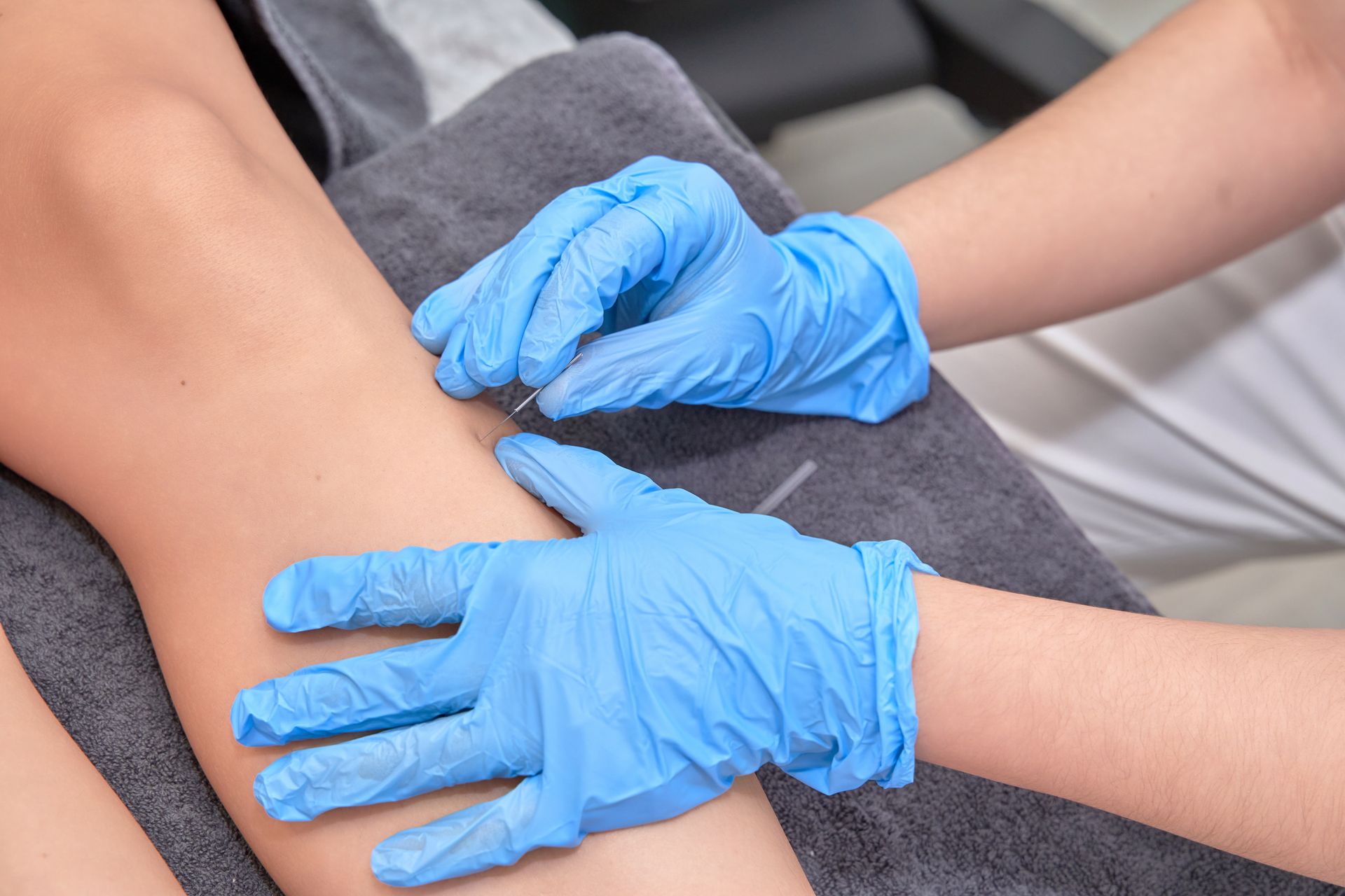 Hands in blue gloves performing acupuncture on a leg.
