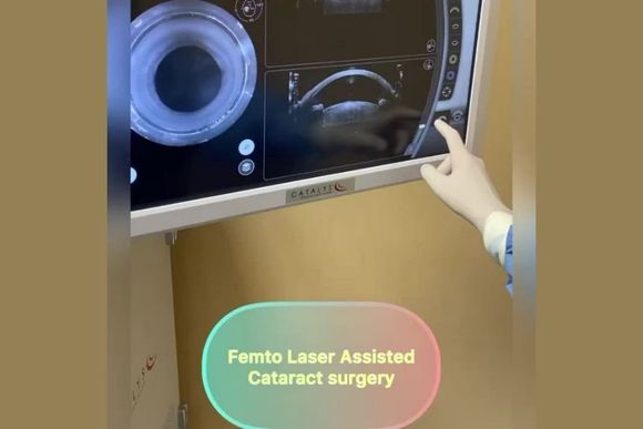 Chirurgia laser per l'occhio