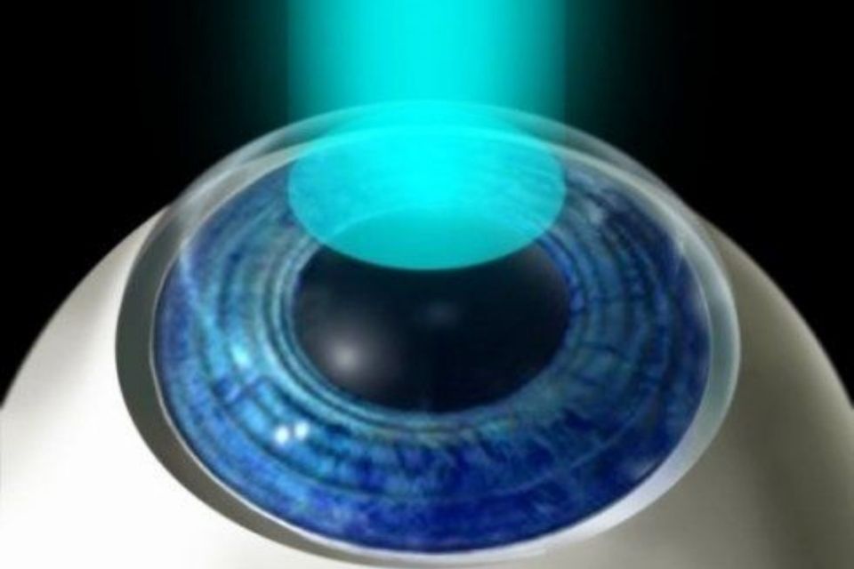 esame per chirurgia refrattiva