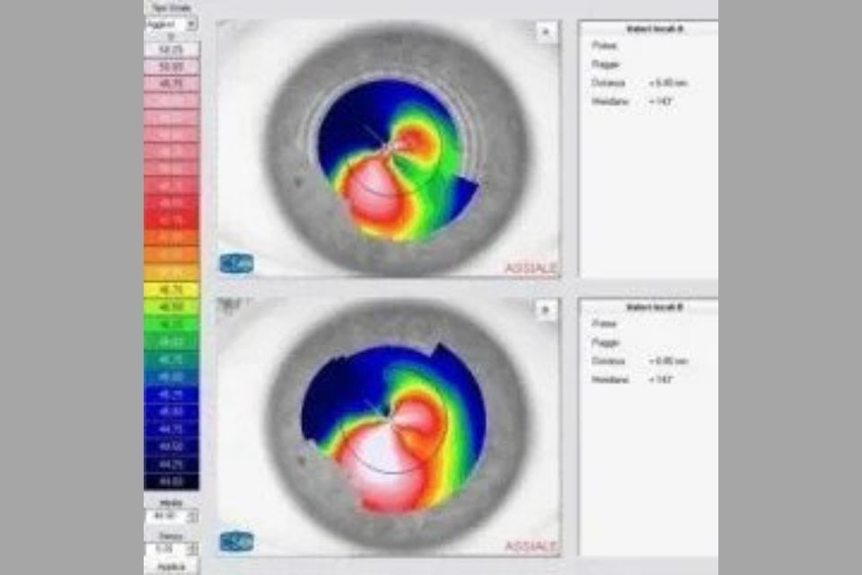 cross-linking accelerato