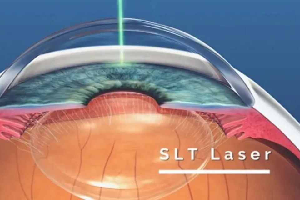 Terapia intravitreale