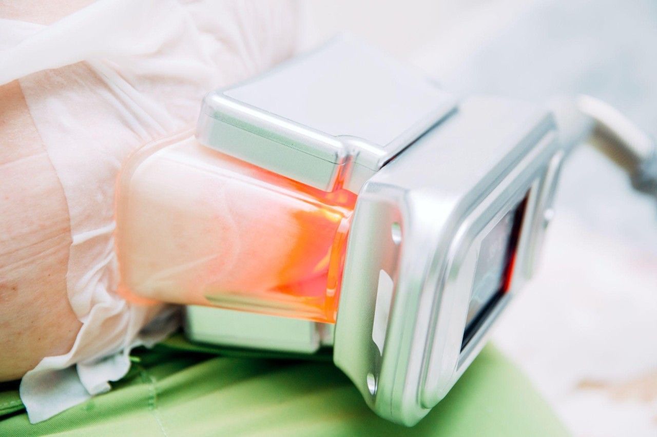 Understand the CoolSculpting Market and Ideal Patient Profile