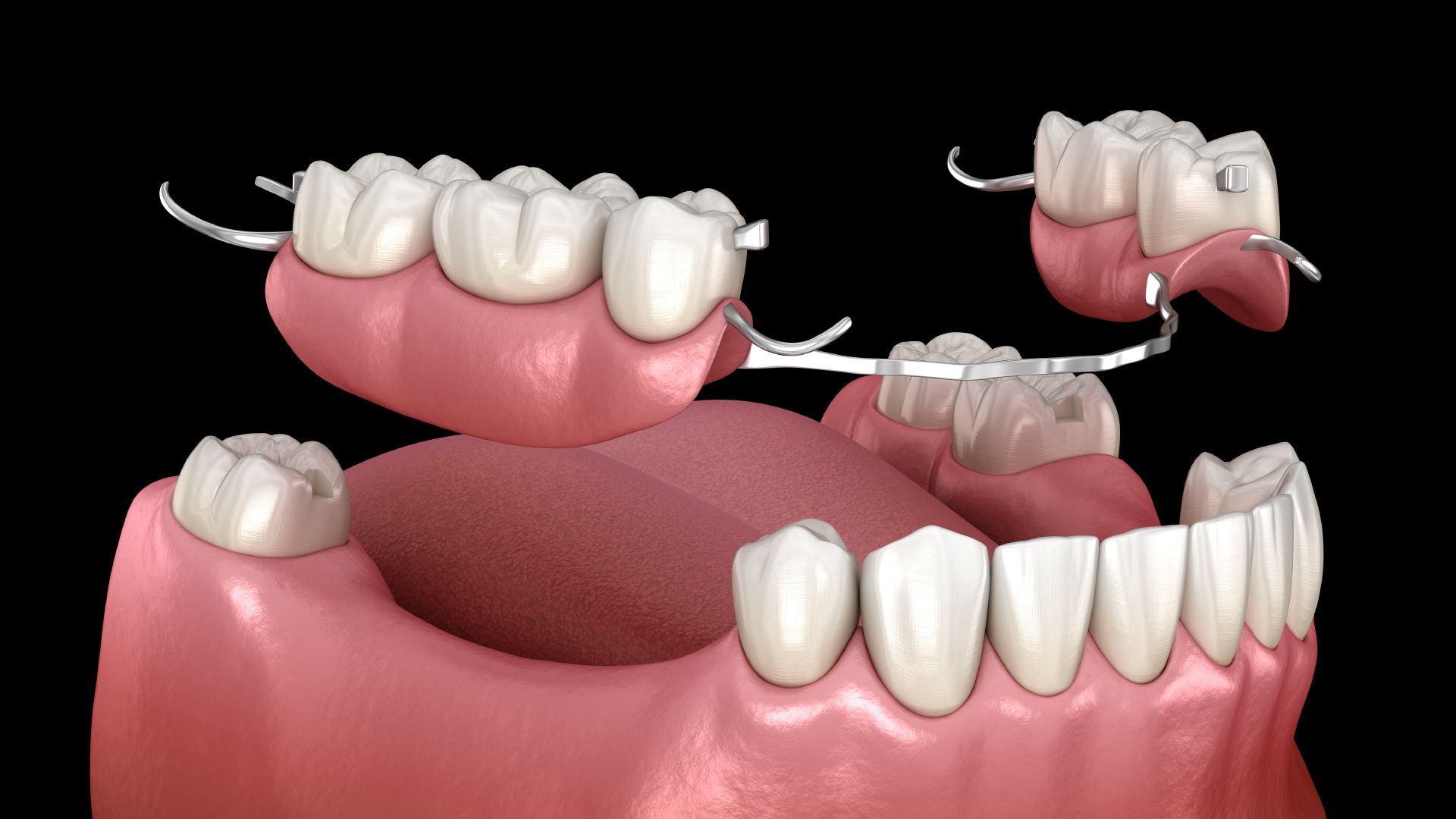 A close up of a person 's mouth with white teeth.