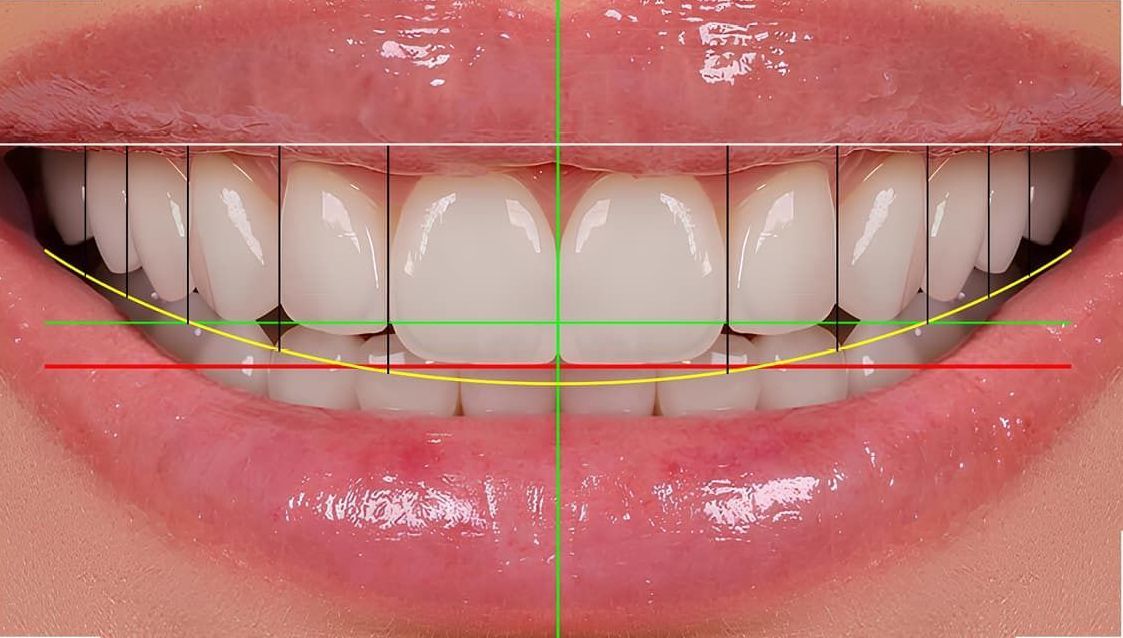 A close up of a woman 's smile with measurements on the teeth.