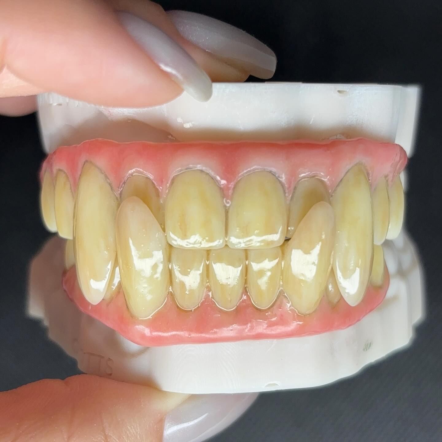 A person is holding a model of a person 's teeth.