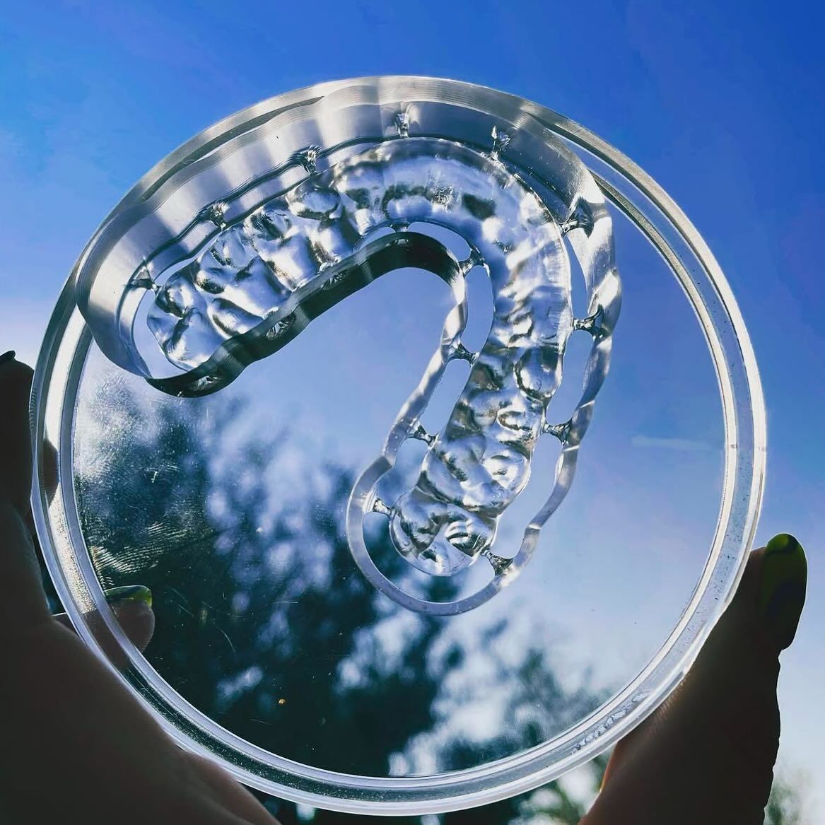 A person is holding a clear mouth guard in their hands