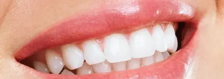 A close up of a woman 's mouth with white teeth and pink lips.
