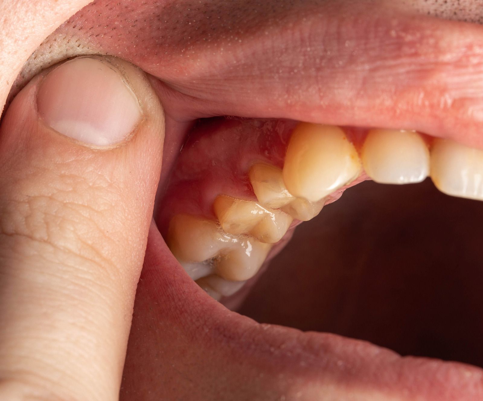 A close up of a person 's mouth with a finger in it.