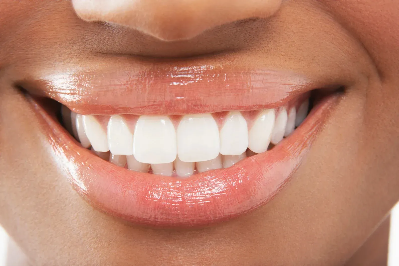 A close up of a woman 's smile with white teeth.