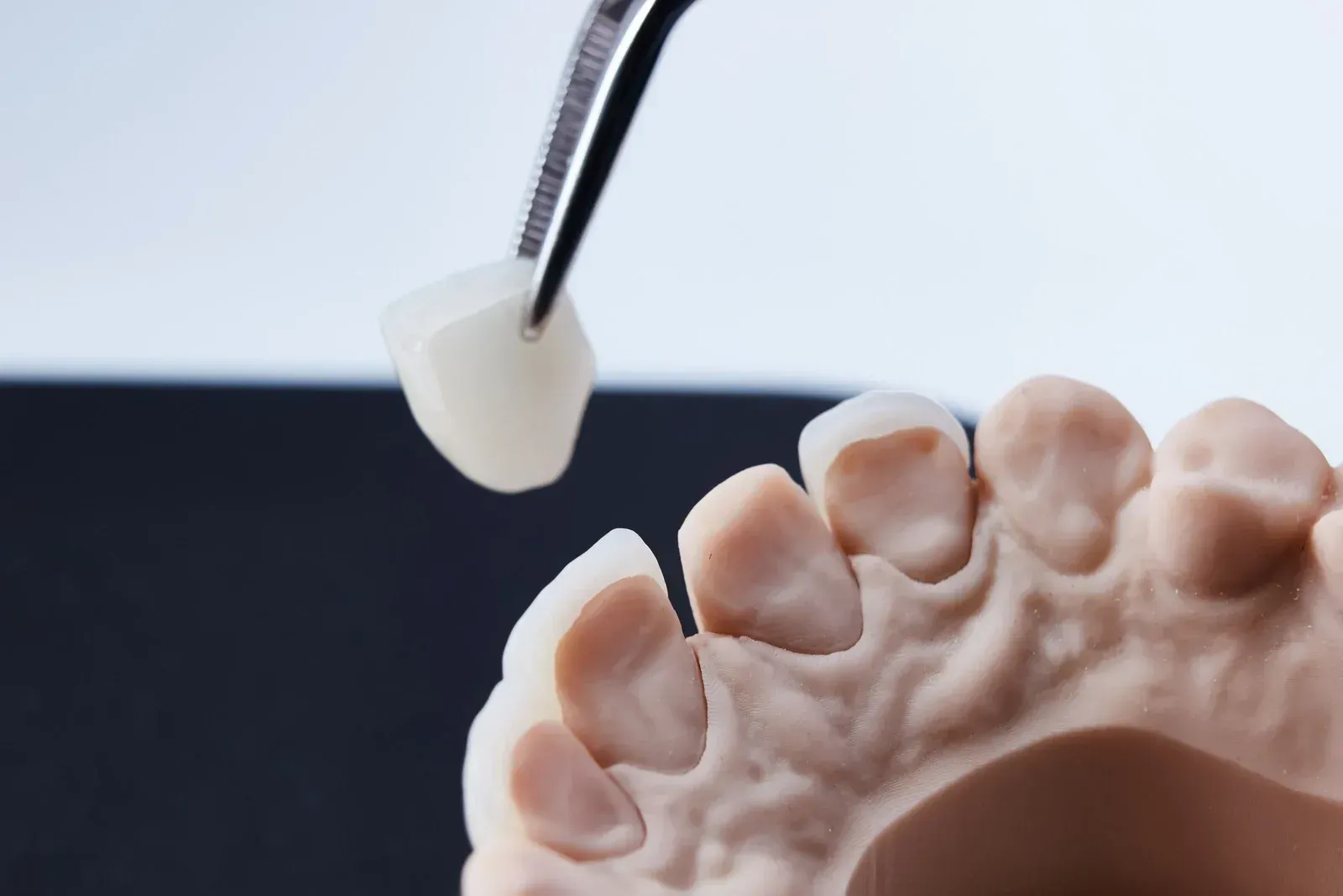 A dental crown is being placed on a model of a tooth