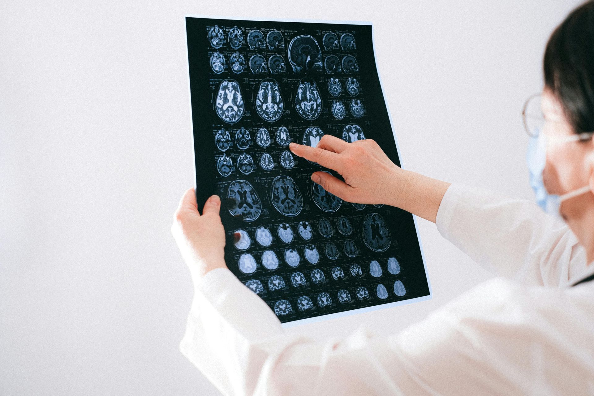 A doctor is holding a ct scan of a person 's brain.