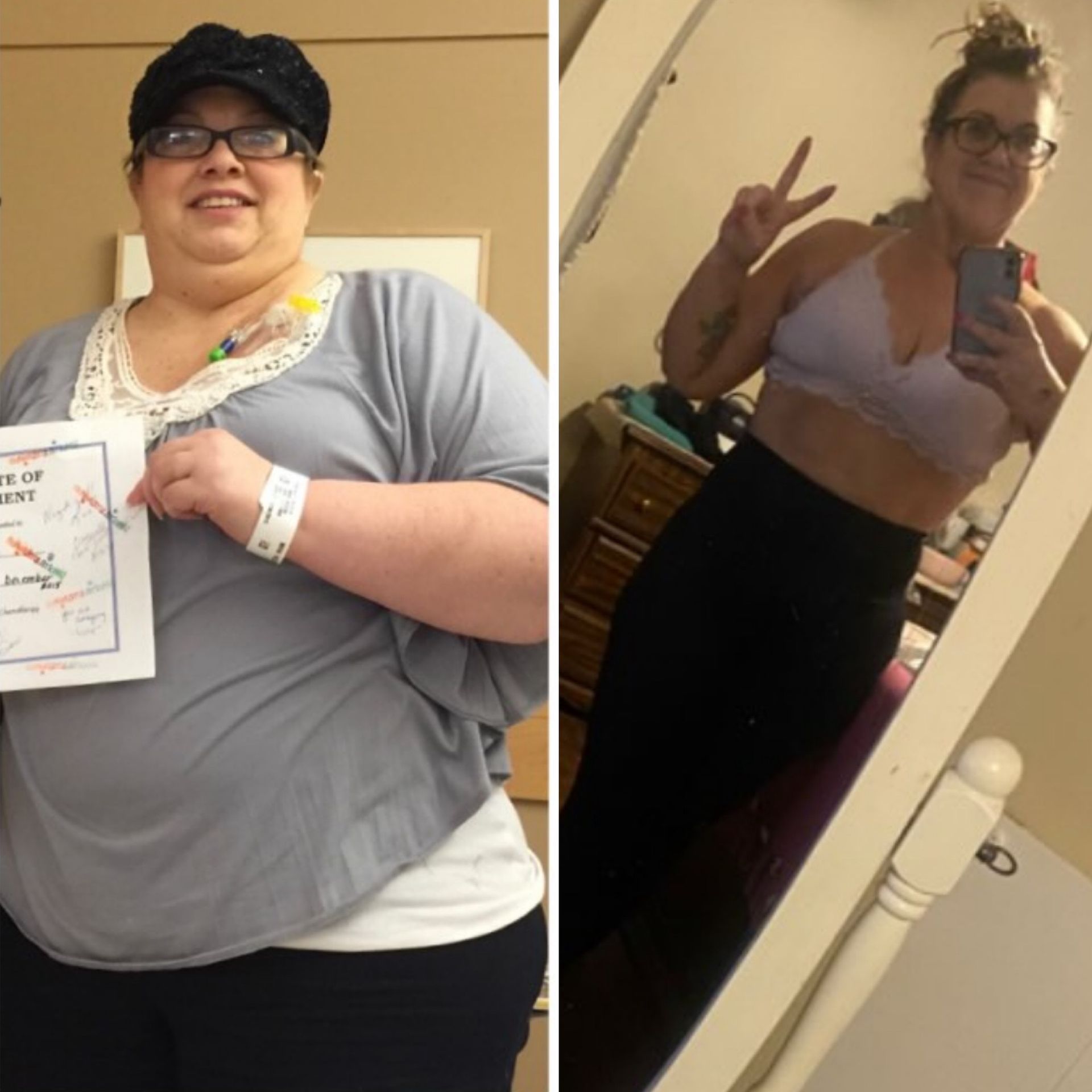 Before and after transformation.