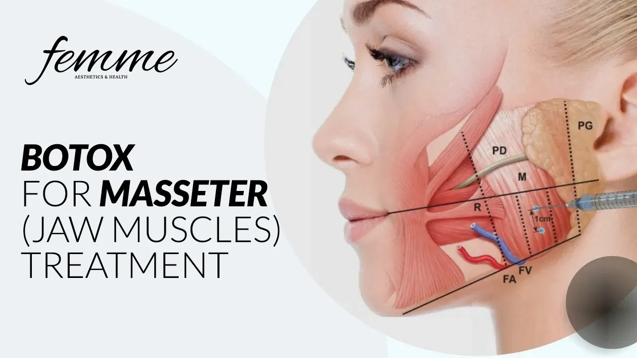 A woman is getting botox for masseter ( jaw muscles ) treatment