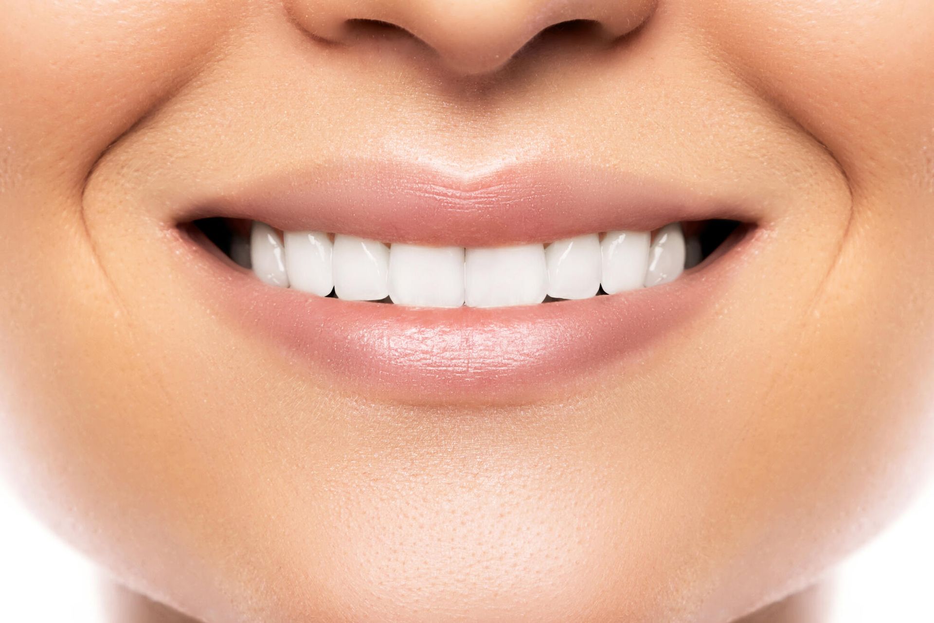 A close up of a woman 's smile with white teeth.