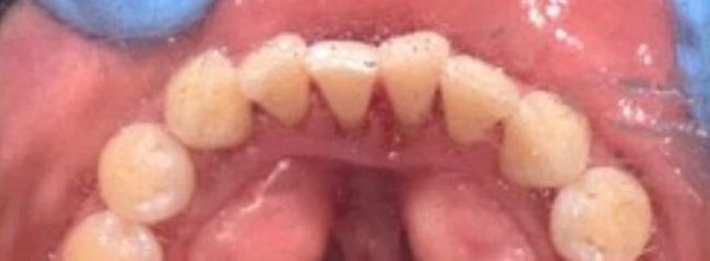 After smile makeover