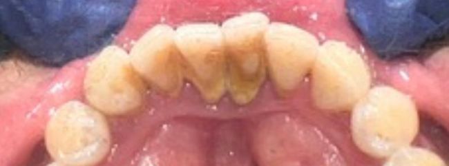 Before smile makeover