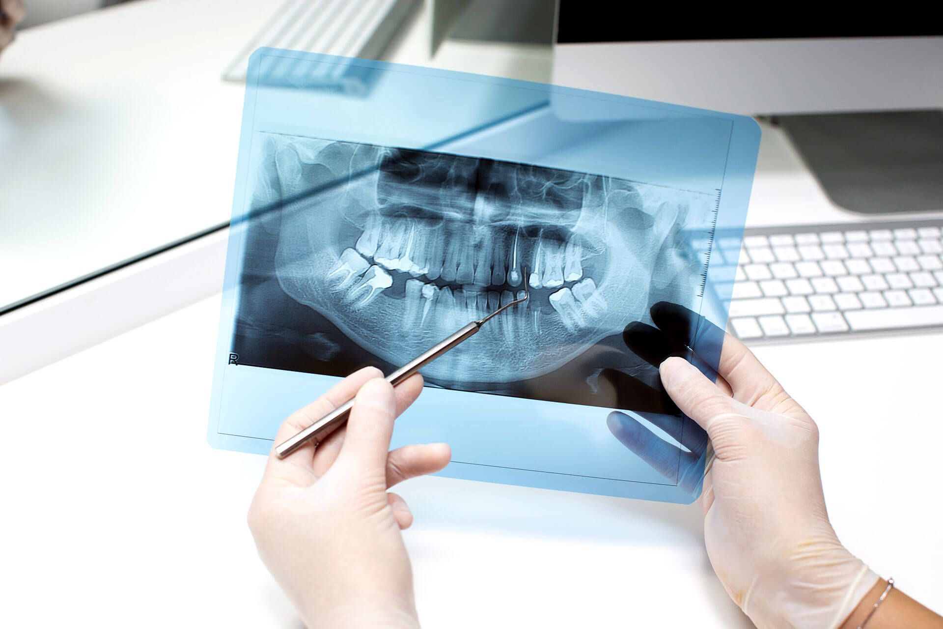 dantų rentgeno nuotraukos