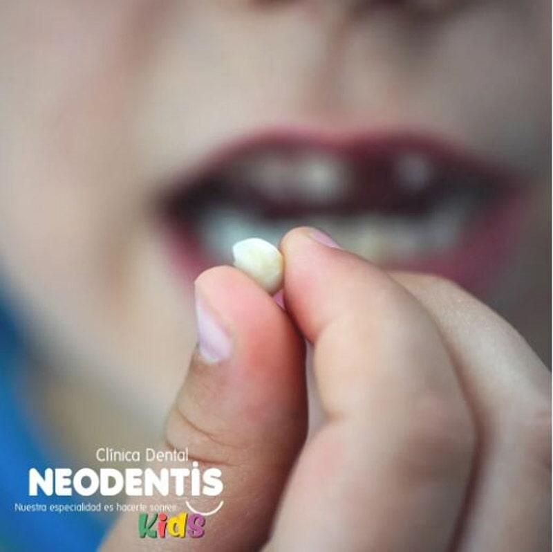 Un niño sostiene un diente en la mano.