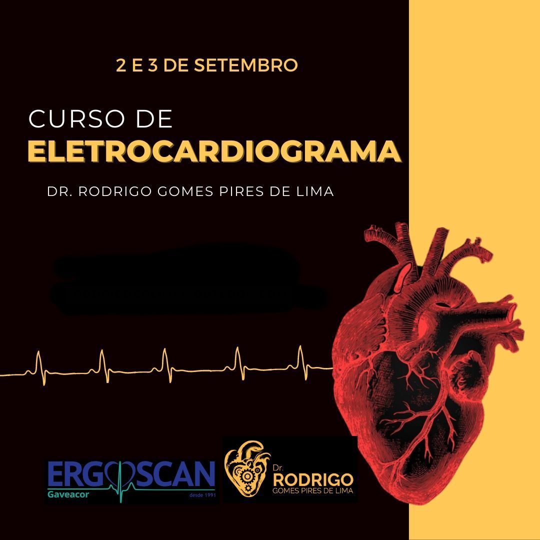 Curso de eletrocardiograma