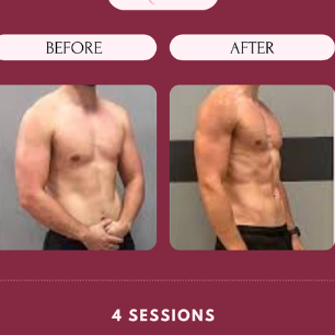 Before-and-after comparison of a man's torso, showing muscle definition after 4 Exopod sessions. The setting is a studio with a burgundy backdrop.