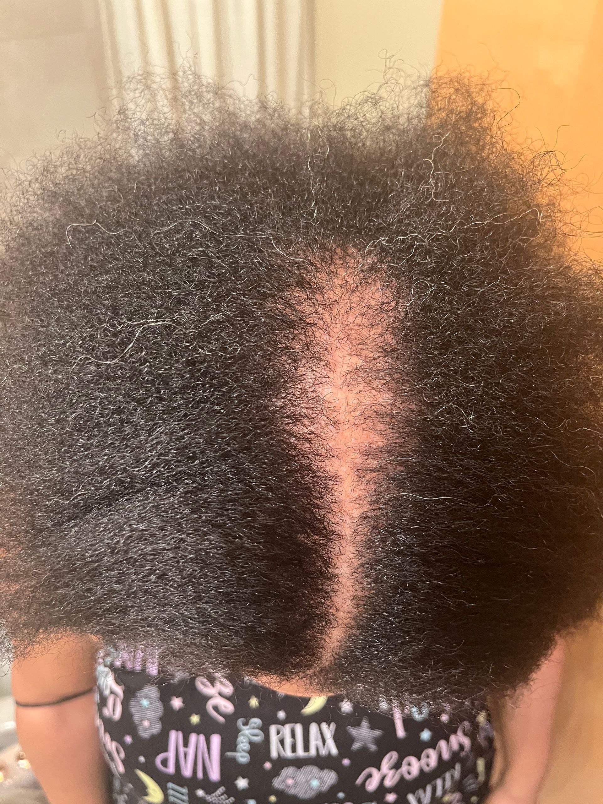 Rosemary Hibiscus Hair Growth Serum