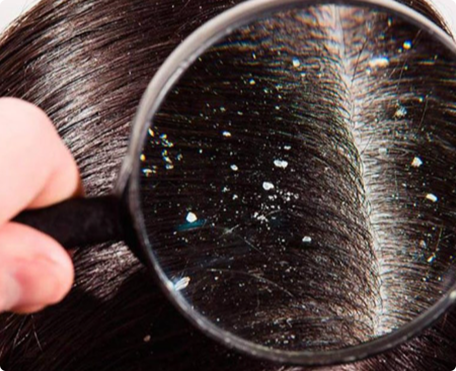 A person is looking at their hair through a magnifying glass.