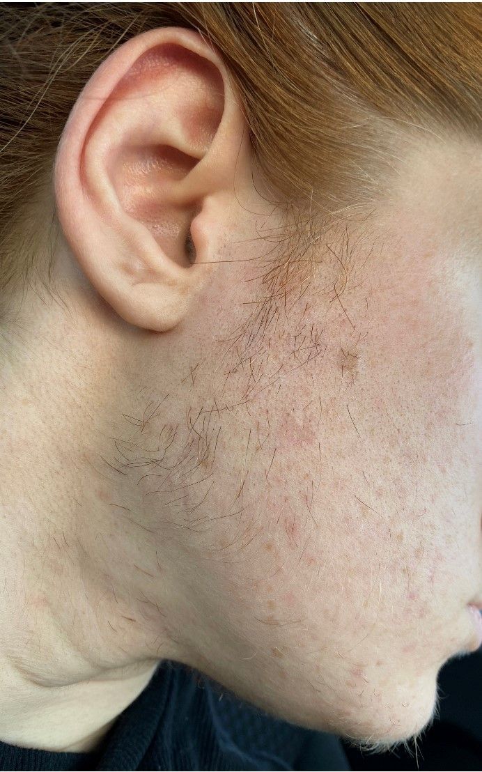 Close-up side profile of a person’s ear, cheek, and jaw with light facial hair against a dark background.