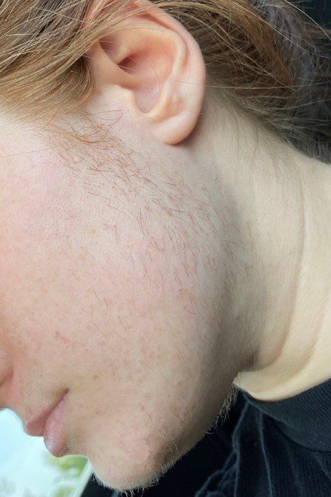 Close-up of a person’s cheek, jawline, and ear in profile, with light skin and tied-back blonde hair.
