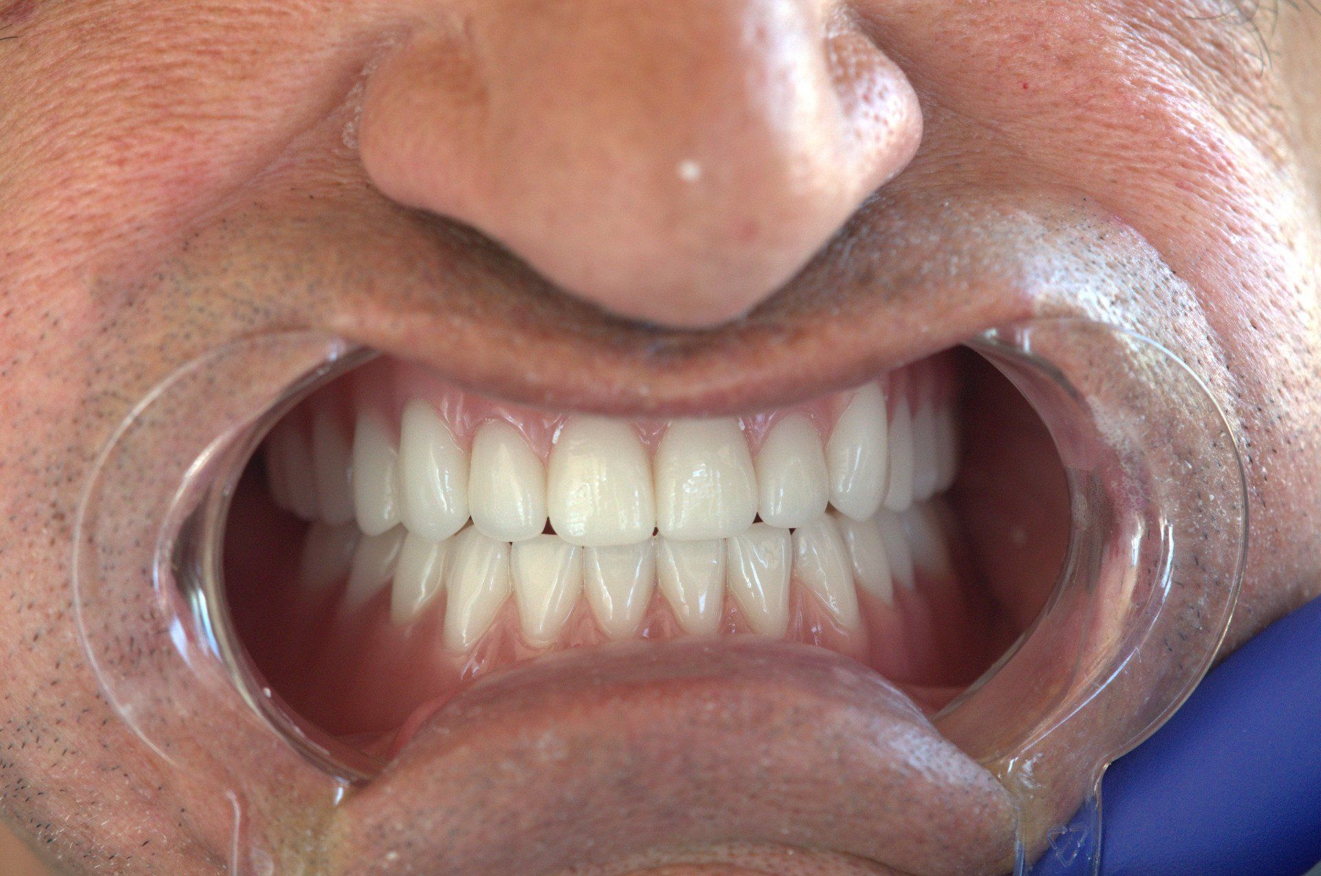 Family Dentist Bradford Ontario | Bradford Dentistry Office On 88