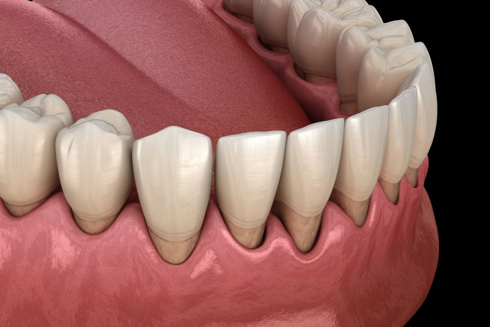 Close-up view of lower teeth and gums, showing healthy, white teeth and pink gums.