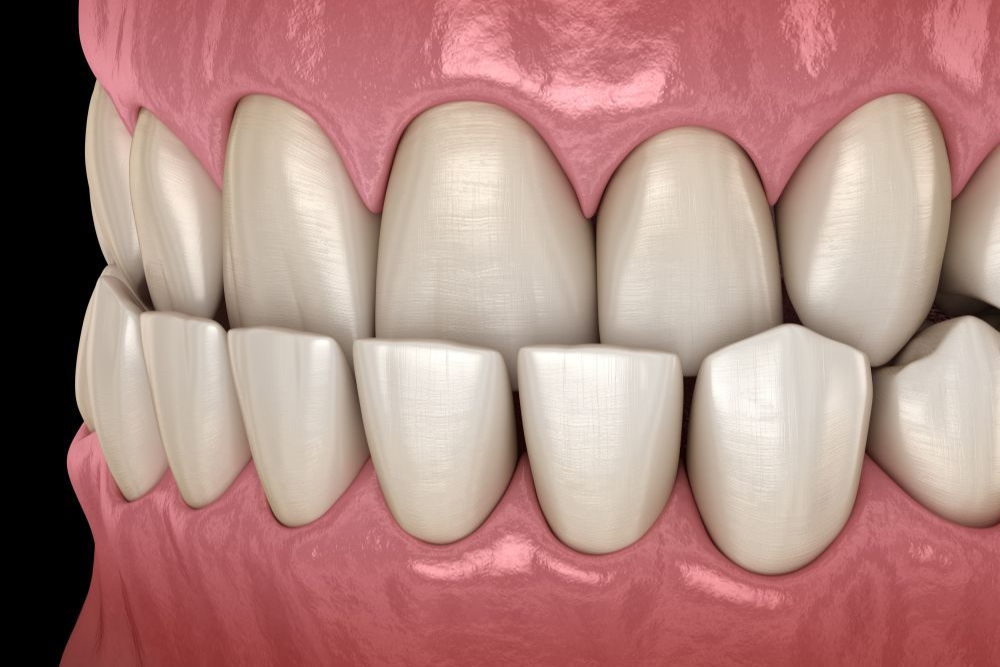 Close-up of human teeth, showing a healthy smile with white teeth and pink gums.