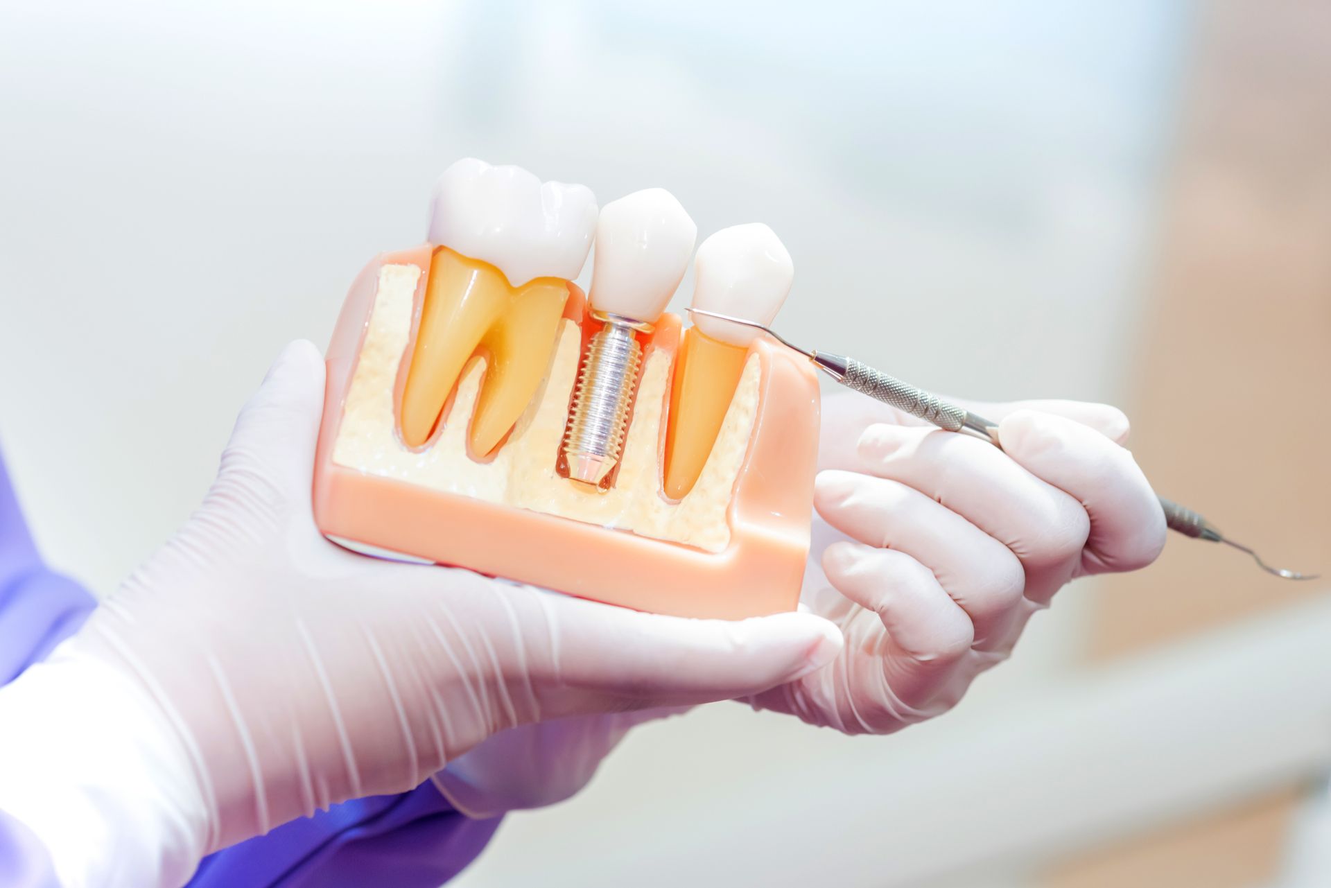 Dentist with tooth implant false teeth.