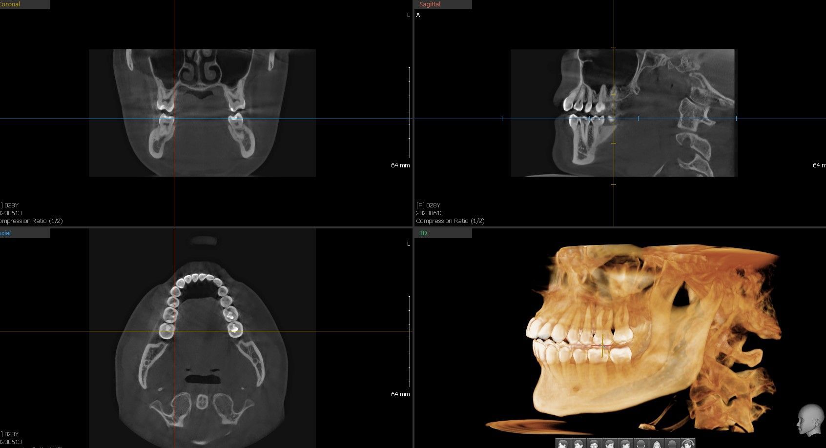 Woman in dental chair, wearing bib, smiling. Dentist is preparing tools in the background.