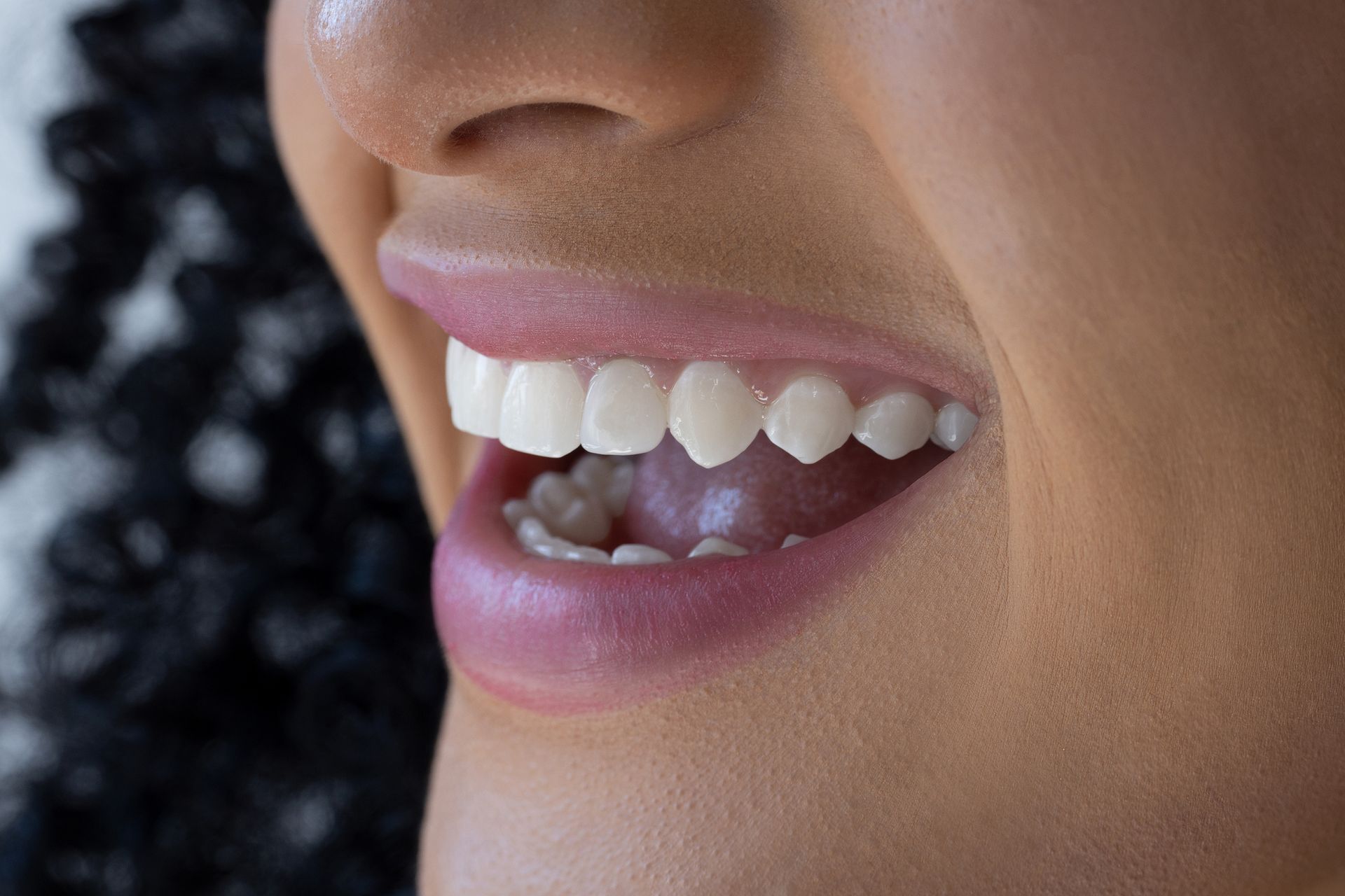 Woman smiling with mouth wide open