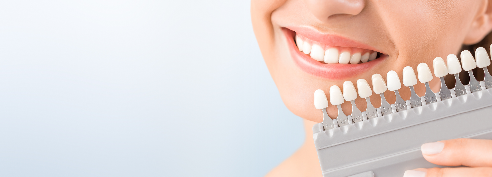 Dental shade guide for teeth whitening and color matching in cosmetic dentistry.