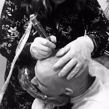 Scalp micropigmentation london