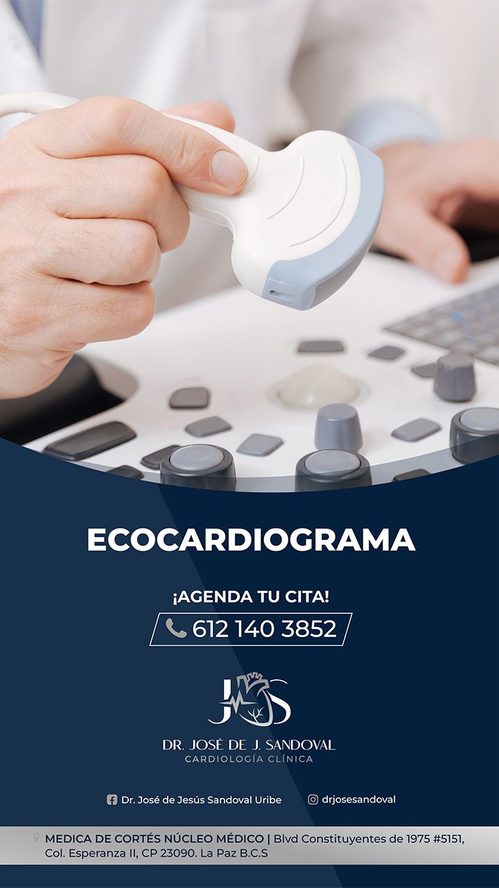 Ecocardiograma