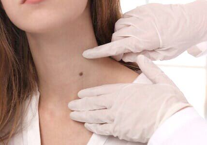 Dermatology — Doctor Examines Mole of a Woman in Bethpage, NY
