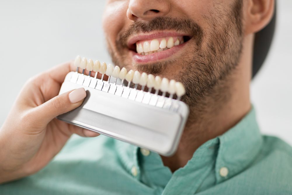 A Man Smiles While a Hand Holds a Teeth Shade Guide Next to His Mouth, Comparing Tooth Color — Smiles on Hobart In Hobart TAS