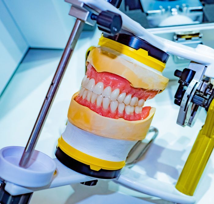 Orthodontics Creating A Dentures —  Smiles on Hobart In Hobart TAS