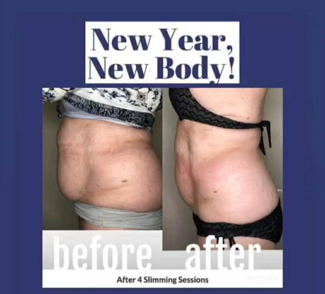 Stomach body sculpting before and after