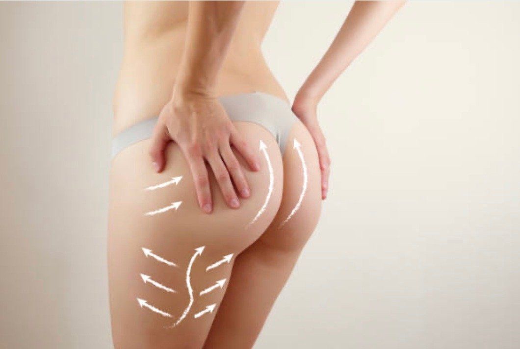 Brazilian_Butt_Lift_Treatment_Benefits