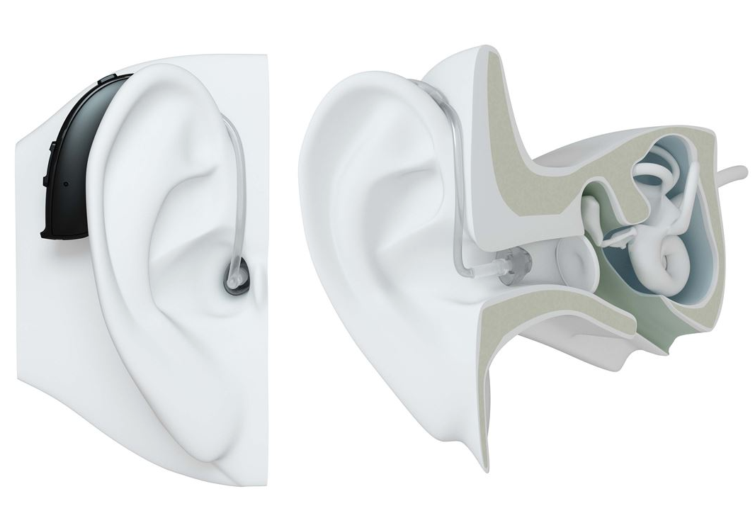 ReSound Behind the ear hearing Aid
