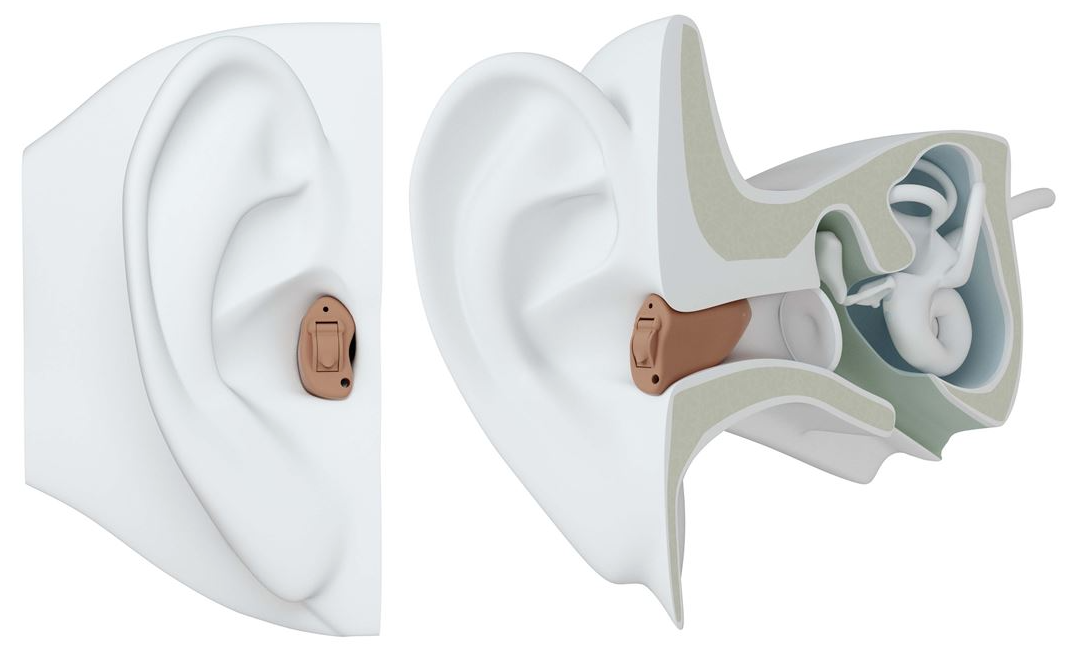 ReSound In-the-canal (ITC) Hearing Aid