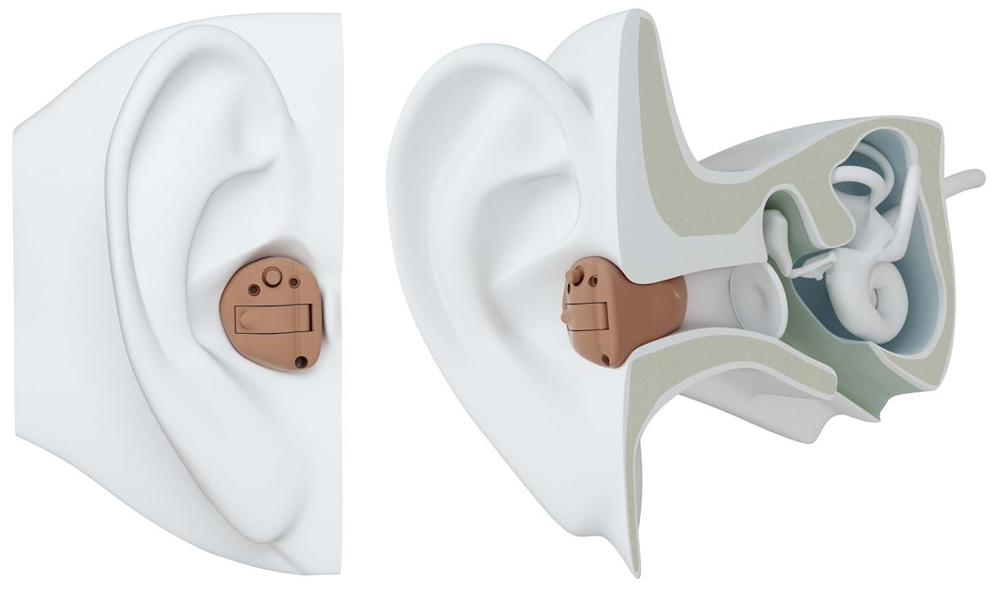 ReSound In-the-ear hearing aids (ITE)