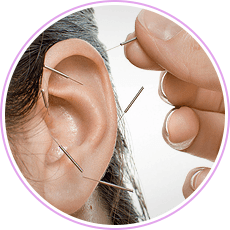 acupuncture for the ear