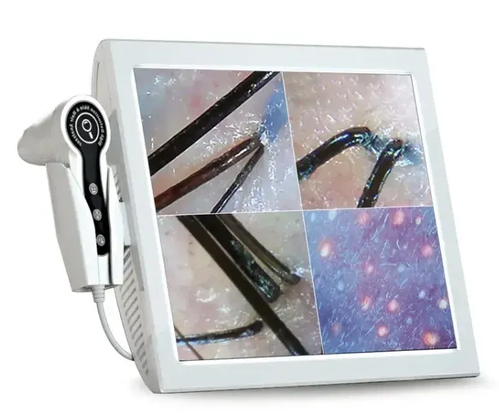 A white device with a screen displaying magnified images of skin and hair.